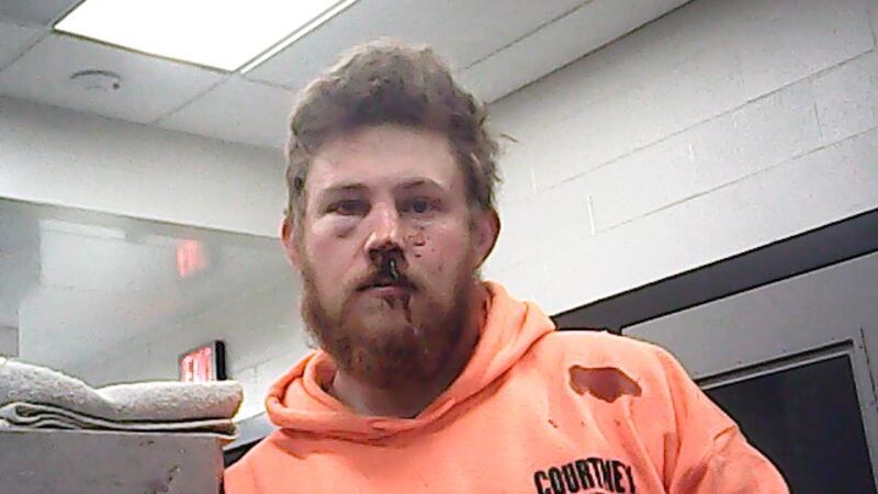 Kody Skaggs was charged with DWI resulting in death and DWI resulting in injury. (Courtesy:...